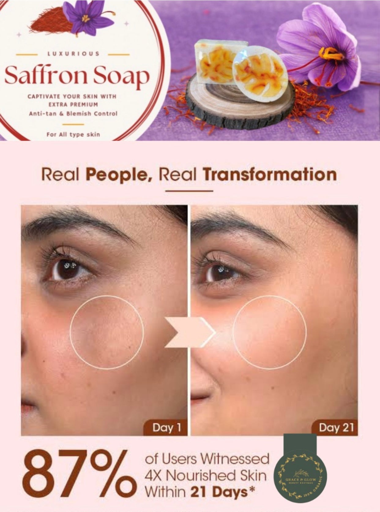 ✨ Saffron & Kojic Acid Whitening Soap Bar – Radiance in Every Wash